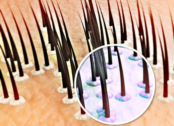 Cual es el mejor champu para la psoriasis y piel atopica